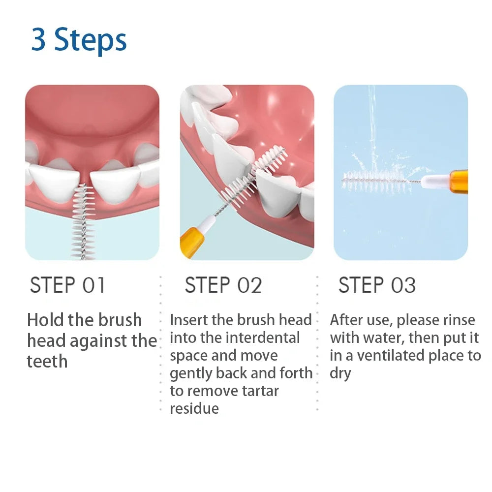 vvocci Orthodontic Interdental Brush 30pcs/Box - Dental Cleaning Tool for Braces & Oral Care Quake