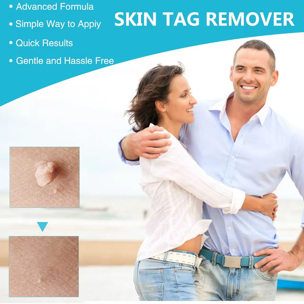 3 In 1 Auto Skin Tag Removal Kit Painless Mole Wart Remover Equipment Micro Skin Tag Treatment Tool Easy To Clean Skin Care Tool Quake