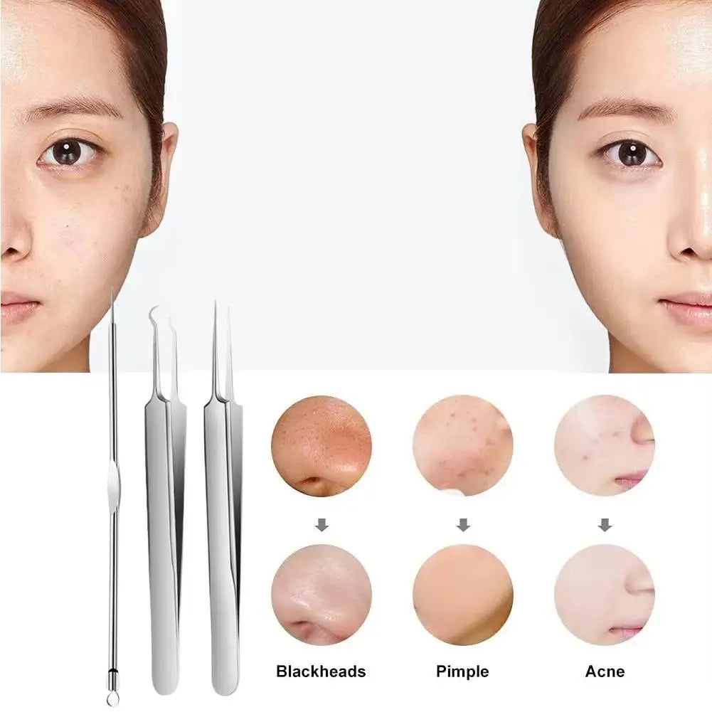 3PCS/kit Acne Needle Blackhead Clip Remover Extraction Pore Black Head Clean Face Skin Care Cleansing Needle Blemish Pick Tool Quake