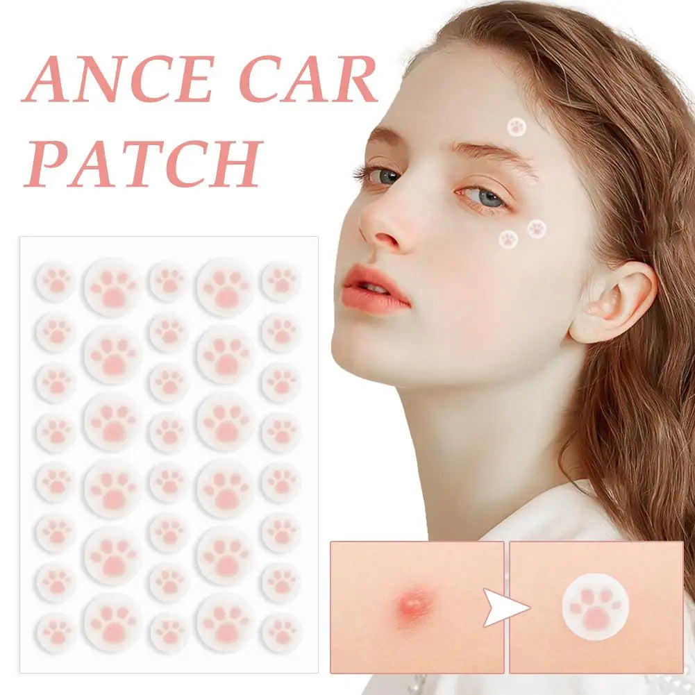 Hydrocolloid Acne Pimple Patch 36 Counts Cute Cat Paws Shaped Acne Absorbing Cover Patch, Invisible For Acne Dots Quake