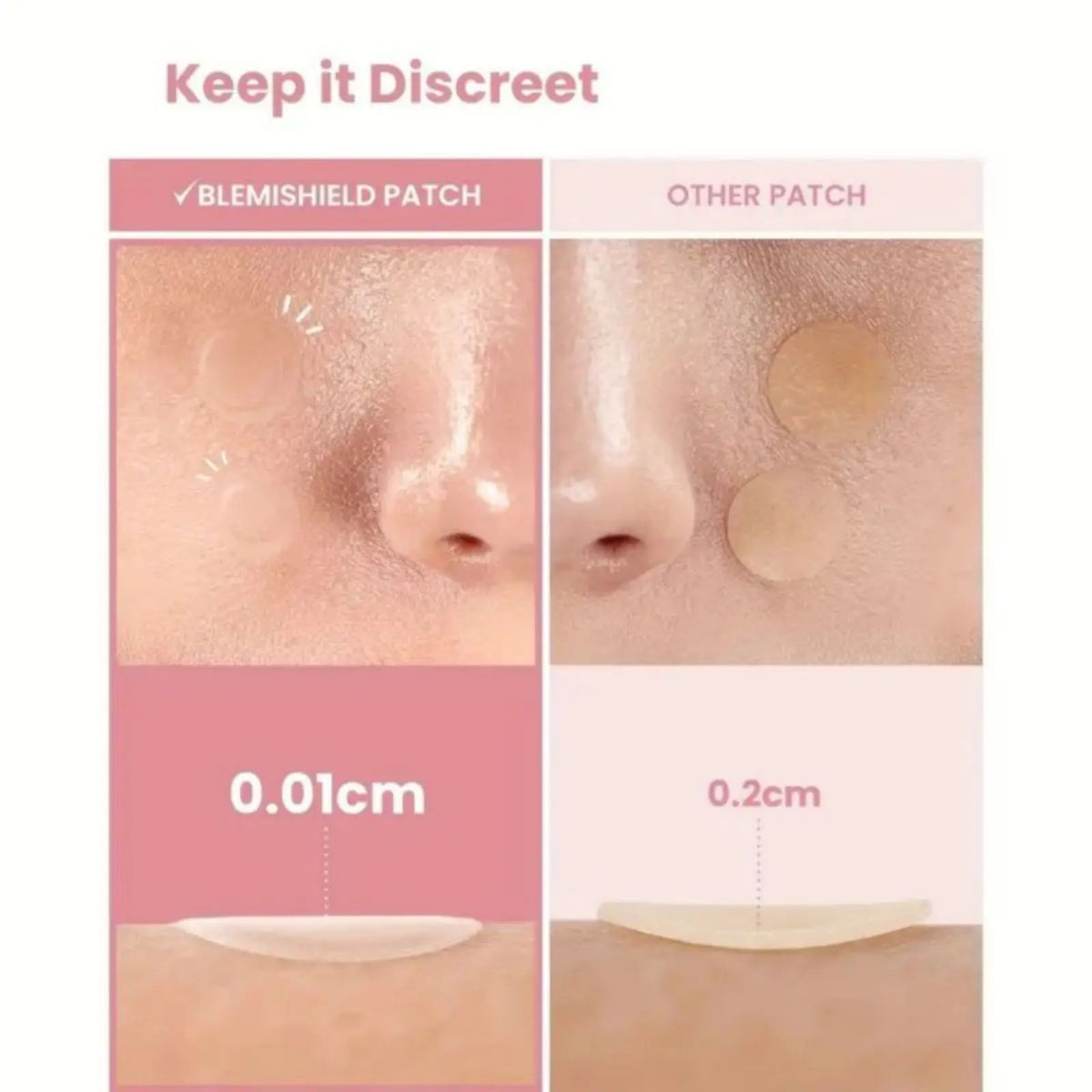36pcs Hydrocolloid Acne Patches - Absorb Pus & Oil, Reduce Redness, Invisible Fit for All-Day Wear. Quake