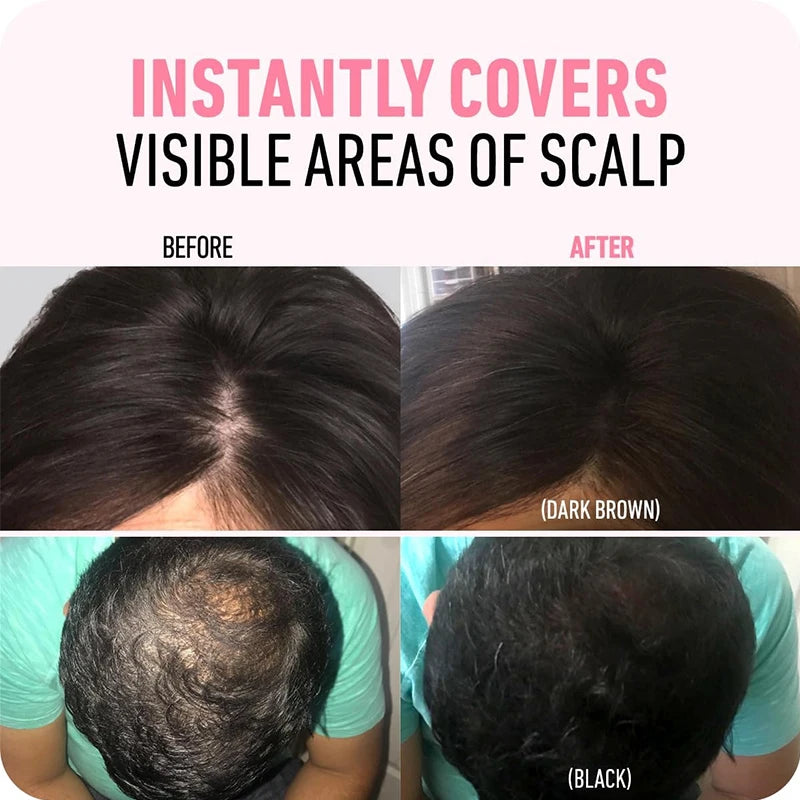 Hairline Powder Instantly Conceals Hair Root Touch Hair Powder for Thinning Hair for Women and Men,Hairline Shadow Powder Makeup Quake