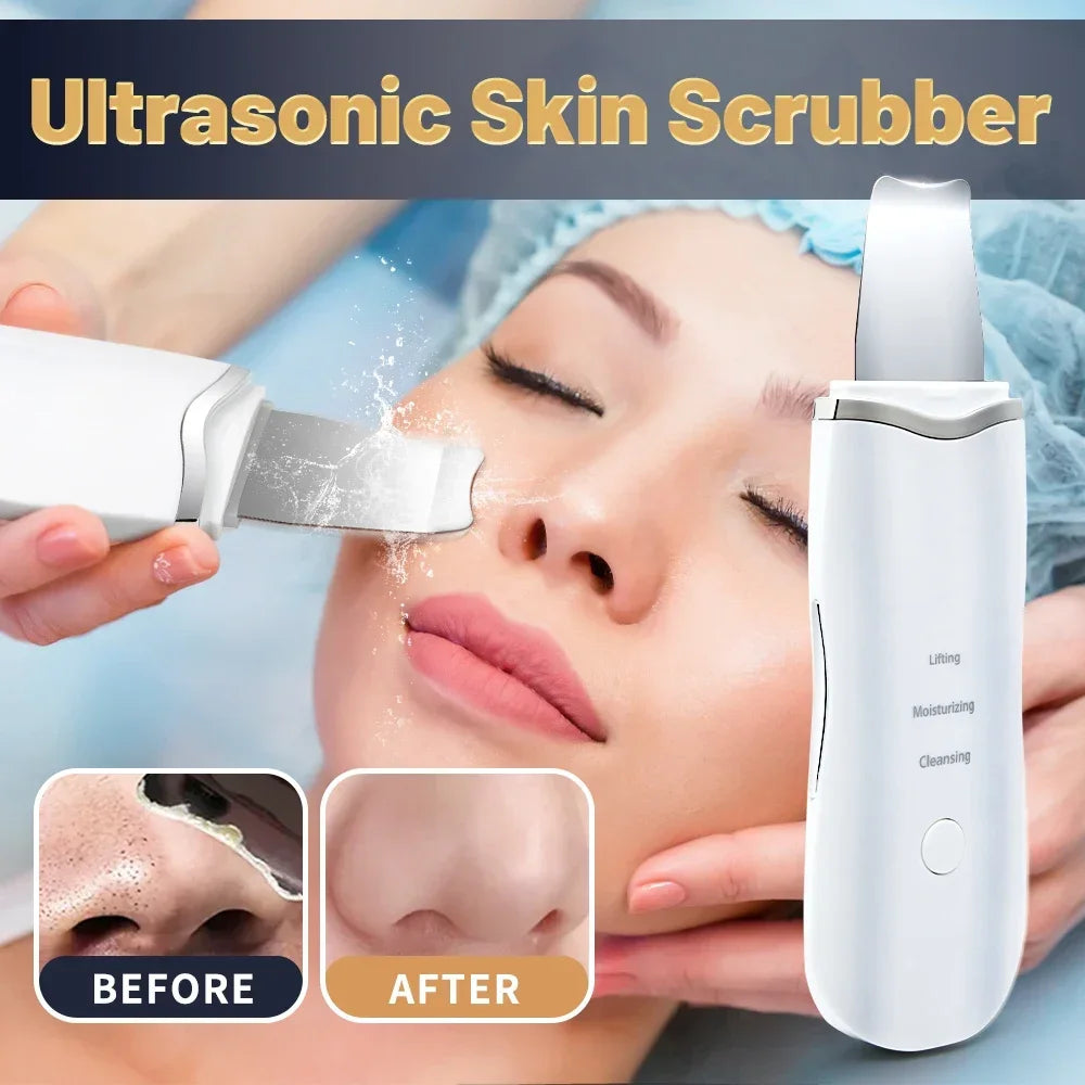 Professional No Ultrasonic Facial Skin Scrubber Ion Deep Face Cleaning Peeling Rechargeable Skin Care Device Beauty Instrument Quake