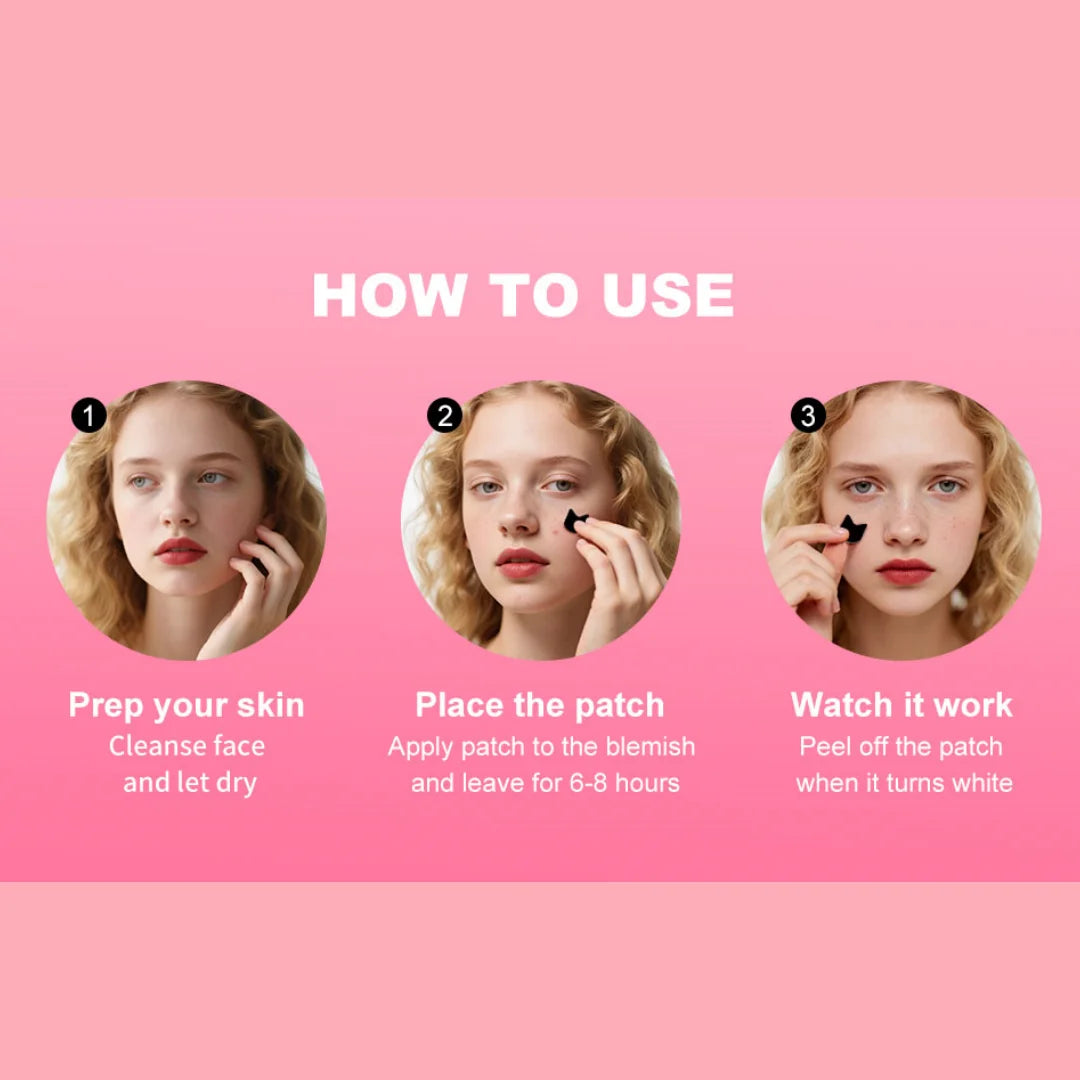 Sanrio Hello Kitty Acne patches, Cartoon acne patches, Acne cover-up stickers, Cute concealer stickers Quake