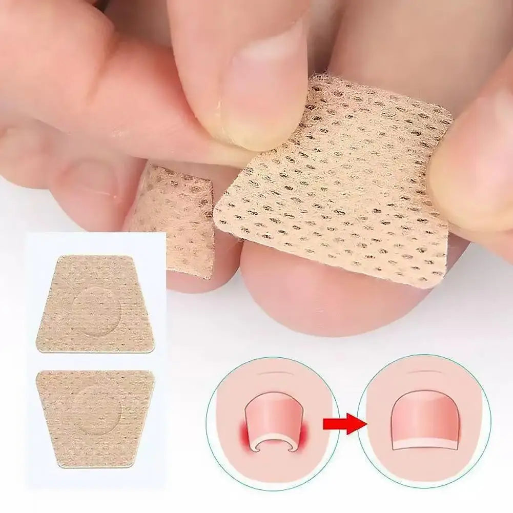Toenail Fungus Patch Nail Repair Patches Nail Ingrown Correction Stickers for Discolored or Damaged Nails Sticker Toenail Care Quake