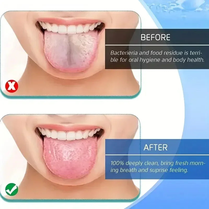 Toothbrush Oral Hygiene Care Tools Tongue Scraper U-shaped 4 Colors Stainless Steel Metal Fresh Breath Cleaning Coated Tongue Quake