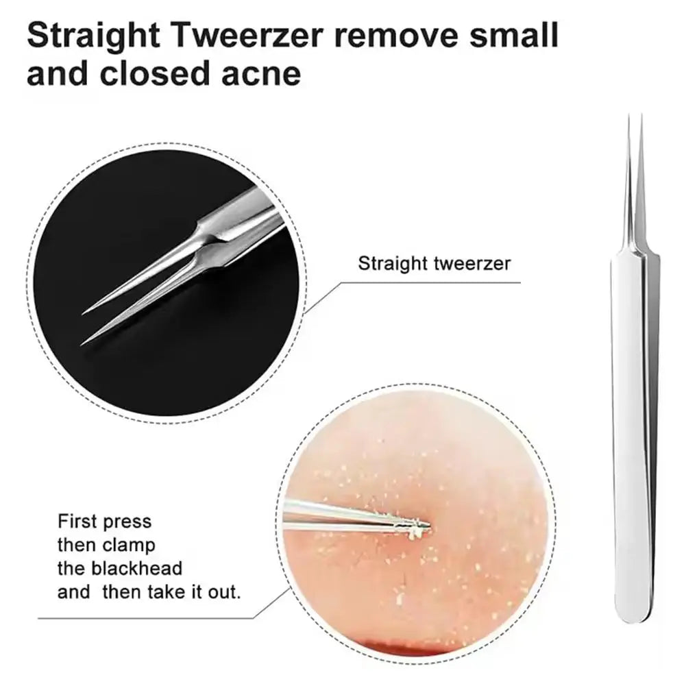 3PCS/kit Acne Needle Blackhead Clip Remover Extraction Pore Black Head Clean Face Skin Care Cleansing Needle Blemish Pick Tool Quake