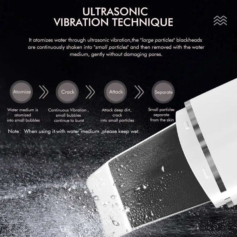 Electric Ultrasonic Skin Scrubber Vibration Face Spatula Peeling Blackhead Remover Facial Lifting Cleansing Ultrasonic Skin Care Quake