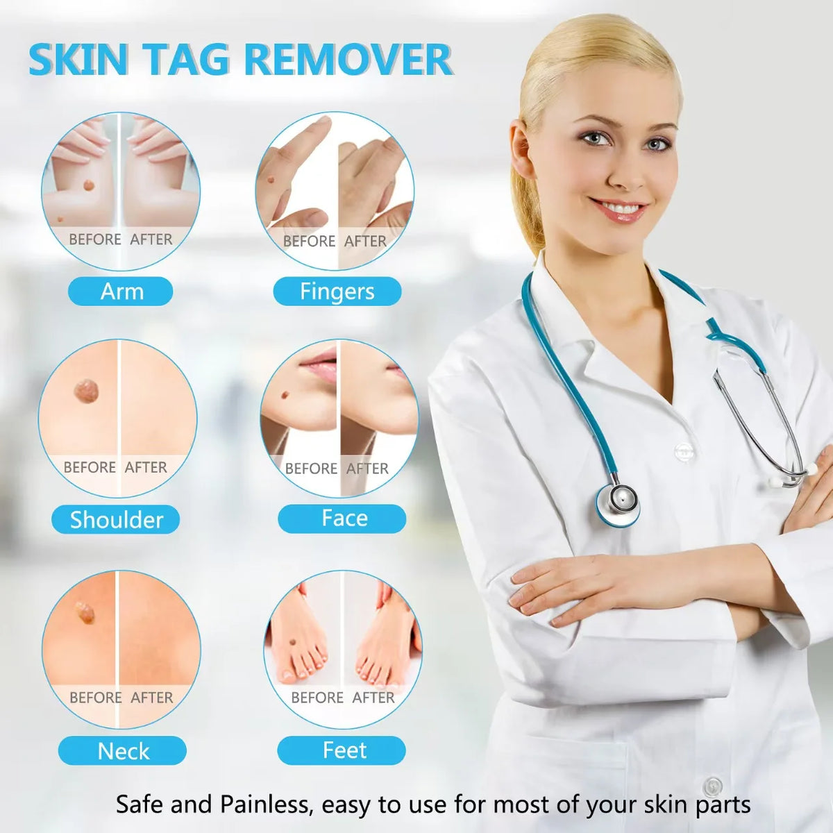 3 In 1 Auto Skin Tag Removal Kit Painless Mole Wart Remover Equipment Micro Skin Tag Treatment Tool Easy To Clean Skin Care Tool Quake
