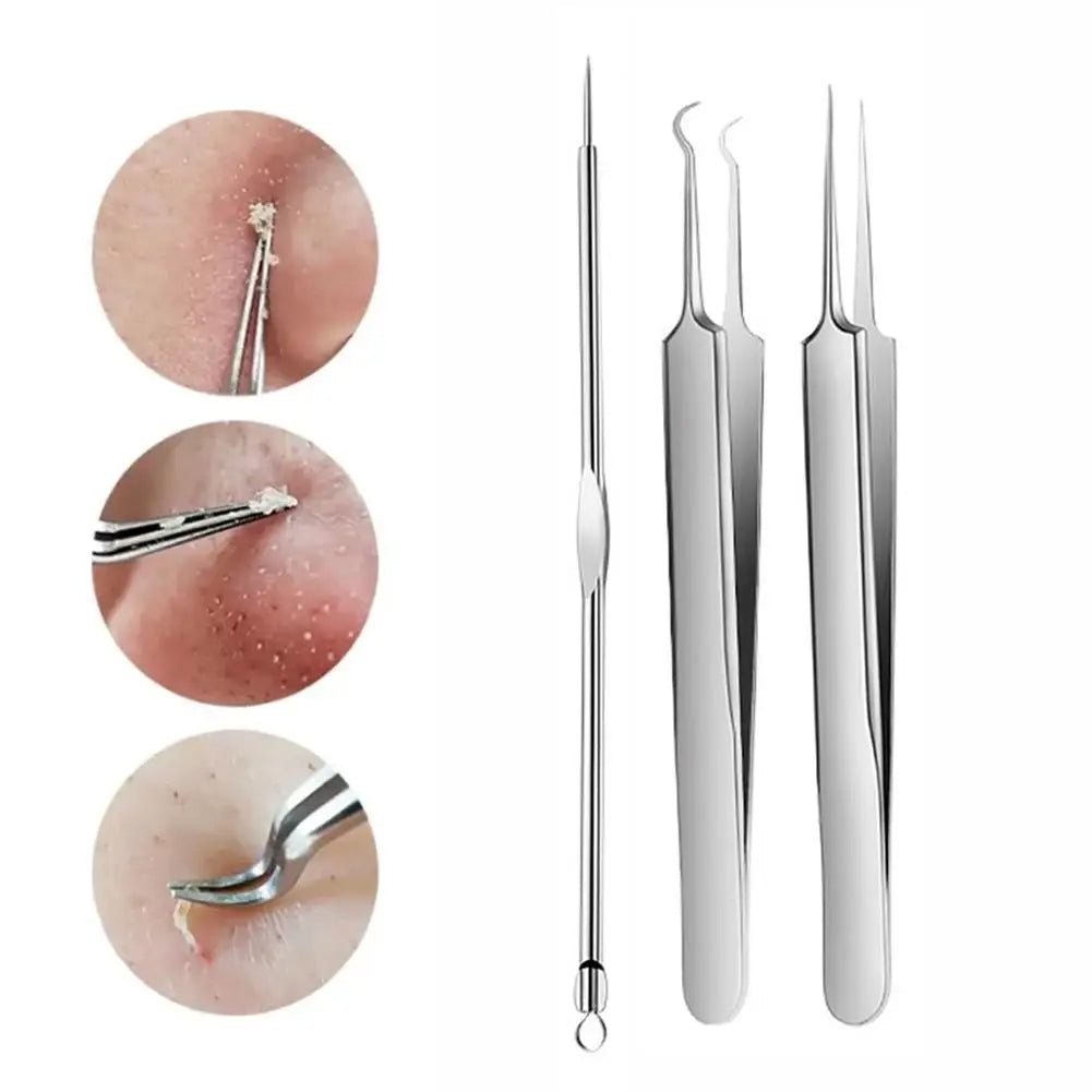 3PCS/kit Acne Needle Blackhead Clip Remover Extraction Pore Black Head Clean Face Skin Care Cleansing Needle Blemish Pick Tool Quake