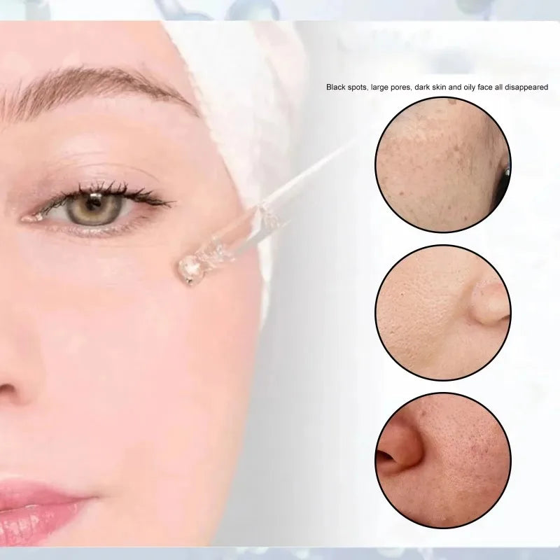Shrink Pores Serum Essence Face Remove Blackheads Oil Control Gel Whitening Moisturizing Smooth Skin Care Product Quake