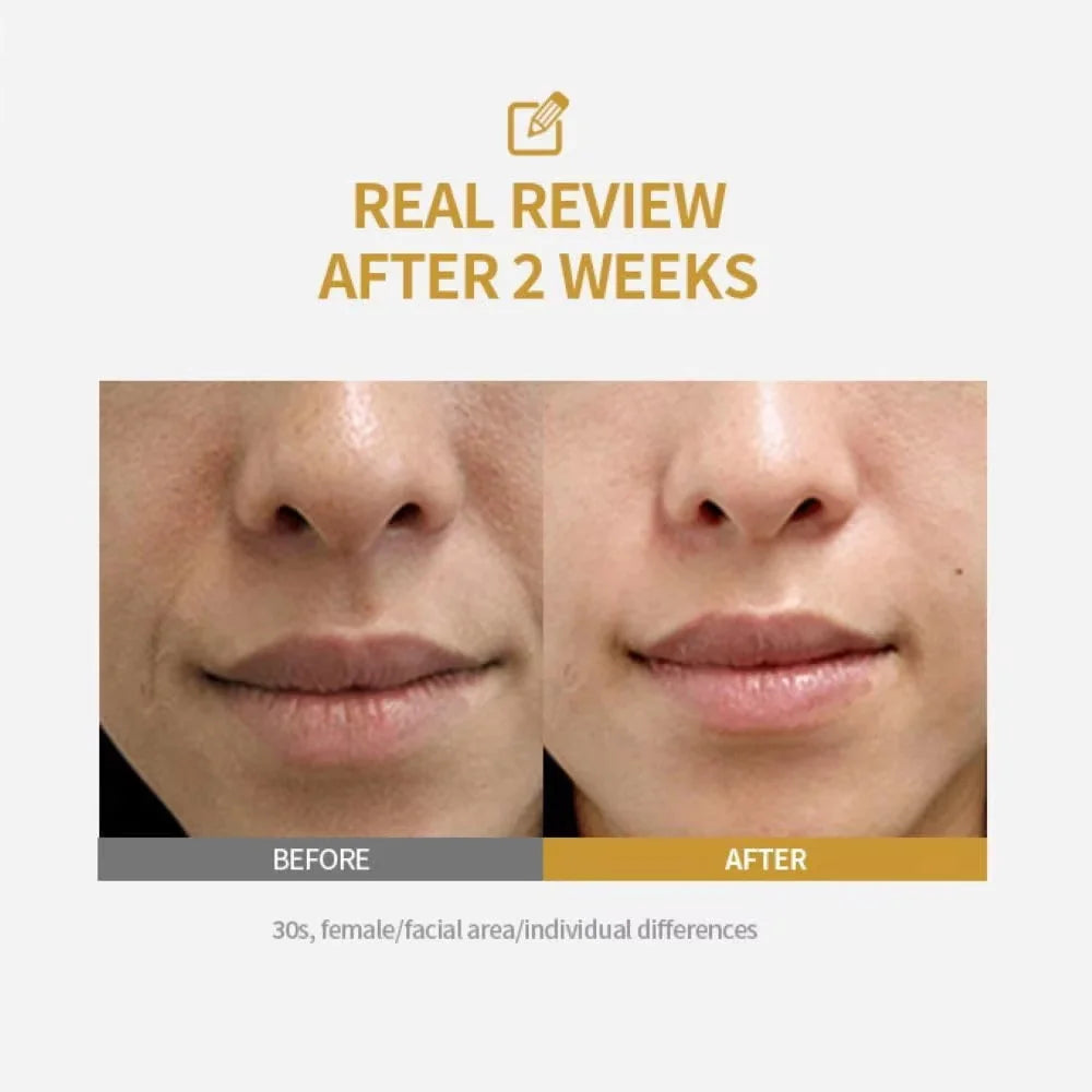 Peptide Intensive Lifting Ampoule,Deep Collagen Face Firming Moisturizing Serum,Glass Skin Tightening Hydration,Korean Skincare Quake