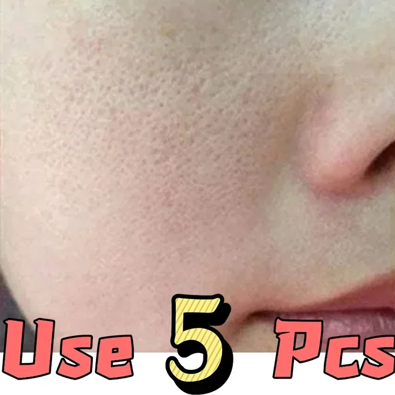 Shrink Pores Serum Essence Face Remove Blackheads Oil Control Gel Whitening Moisturizing Smooth Skin Care Product Quake