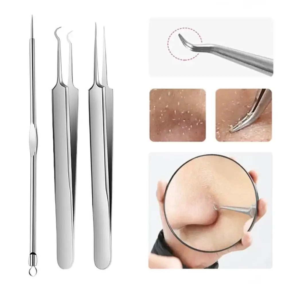 3PCS/kit Acne Needle Blackhead Clip Remover Extraction Pore Black Head Clean Face Skin Care Cleansing Needle Blemish Pick Tool Quake