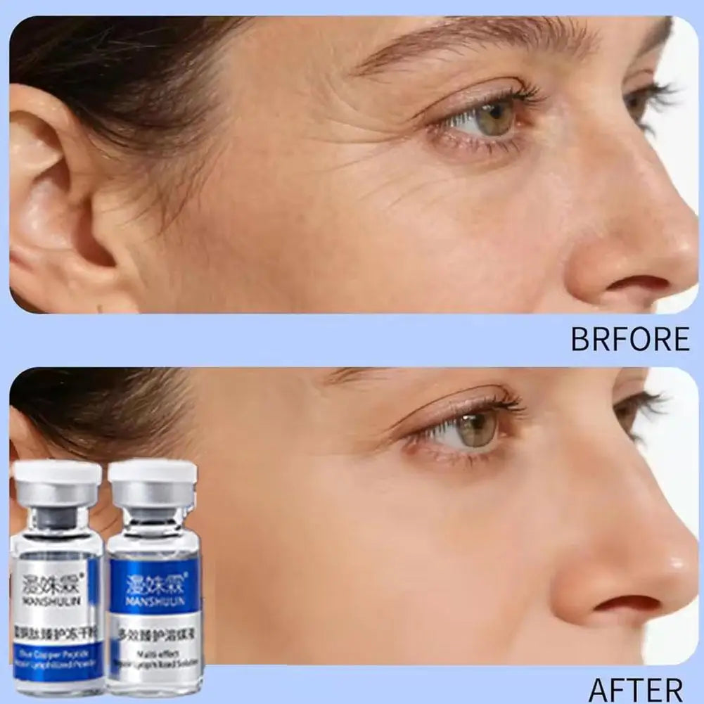 Blue Copper Peptide Repair Lyophilized Powder Box Freeze-dried Firming Essence Anti Aging Shrinks Pores Face Serum Skin Care Set Quake