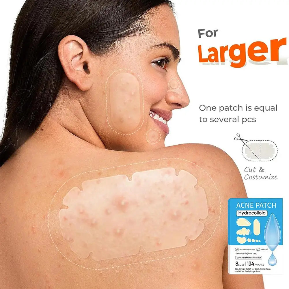 Large Pimple Patches Bulk for Face, 5 Sizes Hydrocolloid Acne Patches for Covering Body, Forehead, Chin Blemishes Zit Breakouts Quake