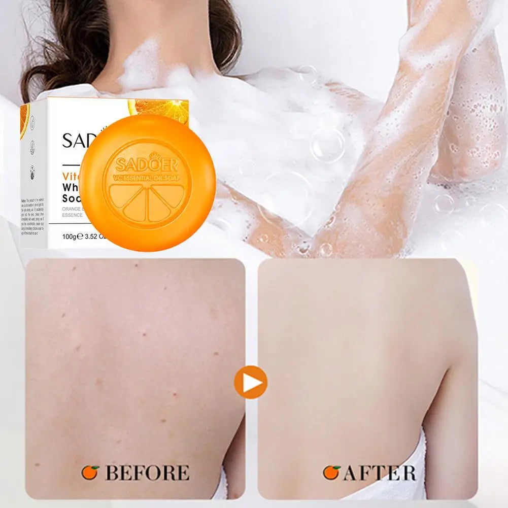 100g Vitamin C Brightening Soap, Hydrating Face & Body For Radiant Glow Skin, Nourishing, Moisturizing Bath Bar with Orange Peel Quake