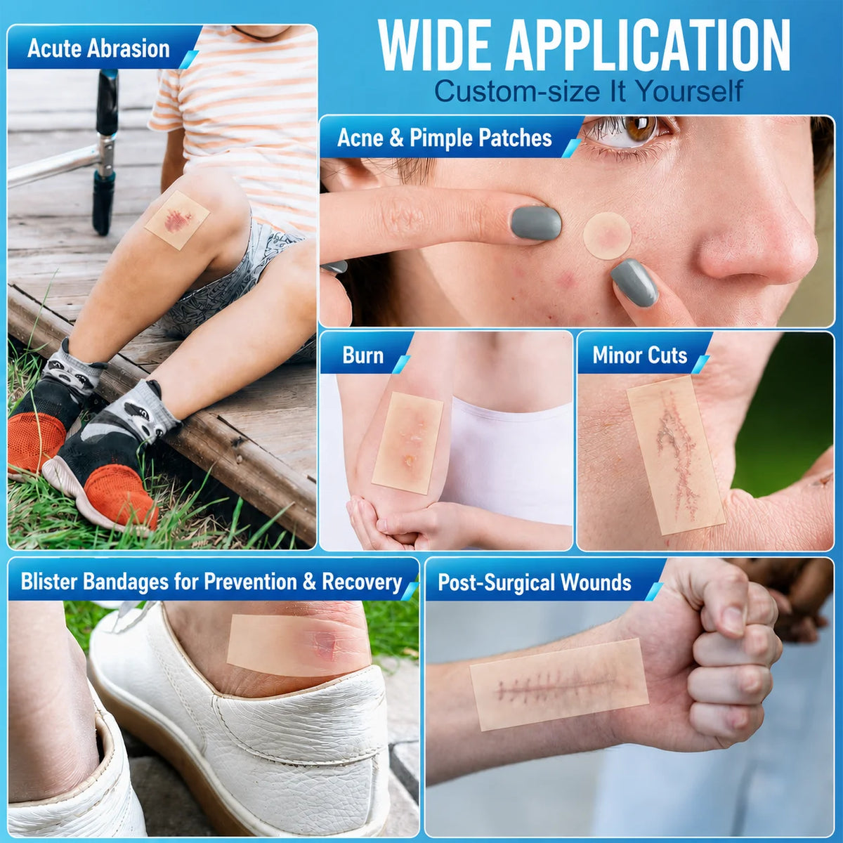 1 volume Pimple Patch Artificial Skin Wound Dressing Freely Cuttable Skin-Friendly Adhesive Keep Wound Clean 1 Roll Value Pack. Quake