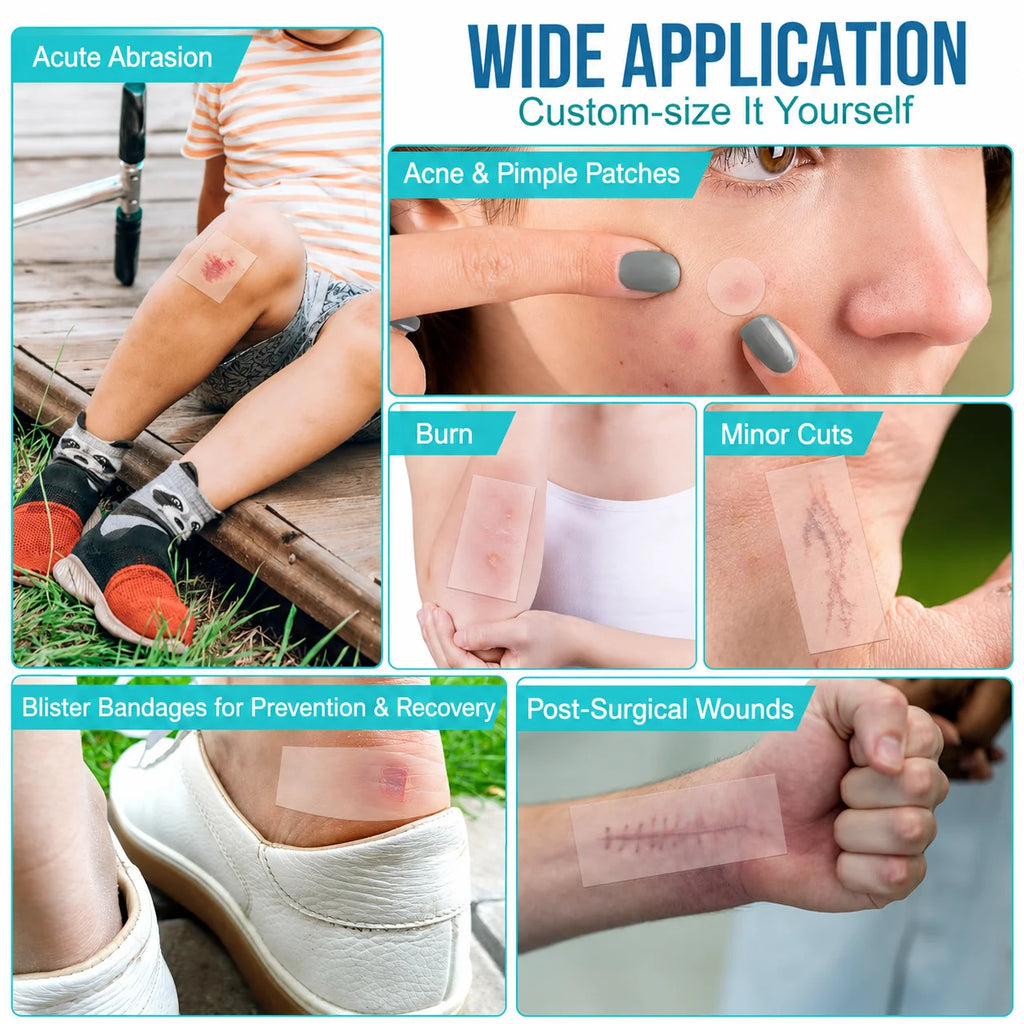 Pimple Patch Artificial Skin Wound Dressing Freely Cuttable Skin-Friendly Adhesive Keep Wound Clean 1 Roll Value Pack. Quake