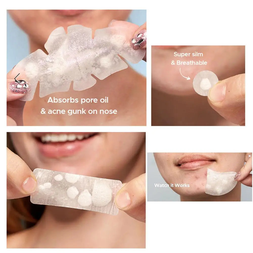Large Pimple Patches Bulk for Face, 5 Sizes Hydrocolloid Acne Patches for Covering Body, Forehead, Chin Blemishes Zit Breakouts Quake