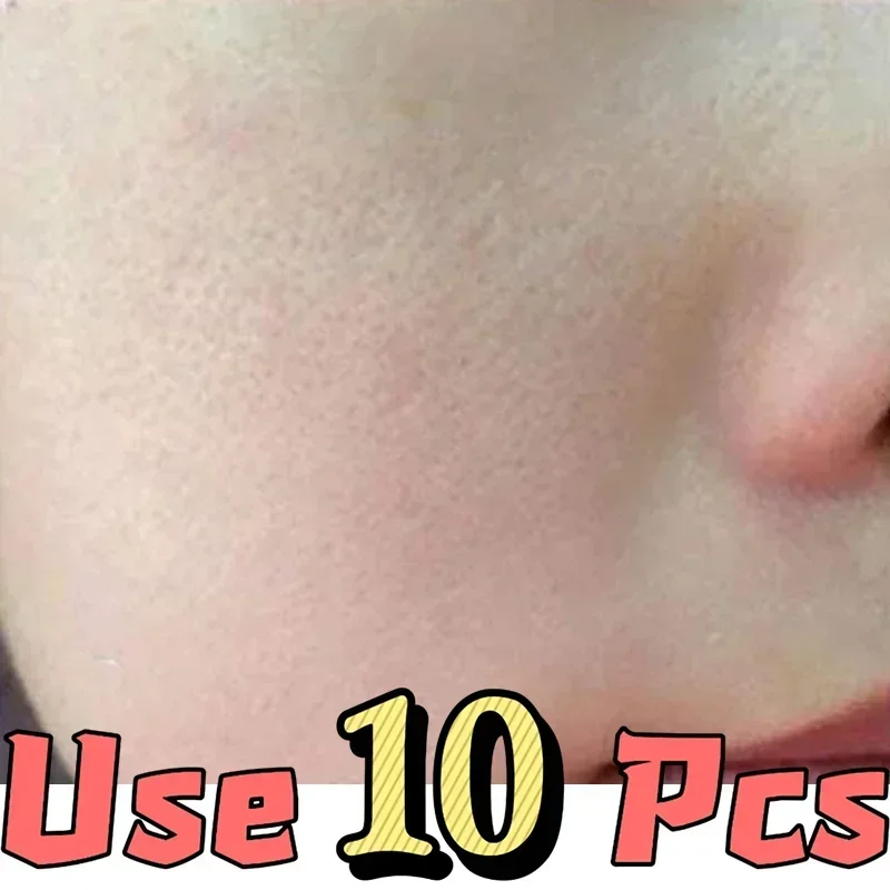 Shrink Pores Serum Essence Face Remove Blackheads Oil Control Gel Whitening Moisturizing Smooth Skin Care Product Quake