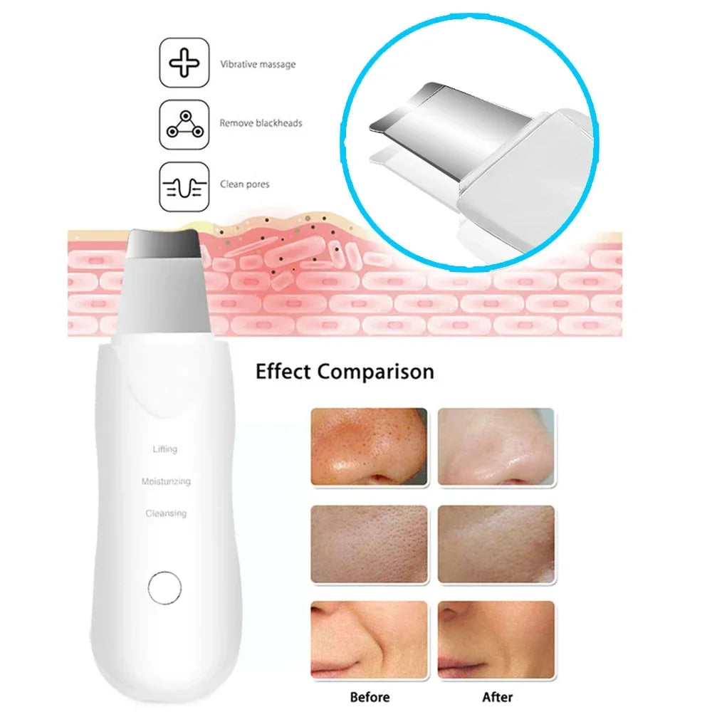 Professional No Ultrasonic Facial Skin Scrubber Ion Deep Face Cleaning Peeling Rechargeable Skin Care Device Beauty Instrument Quake