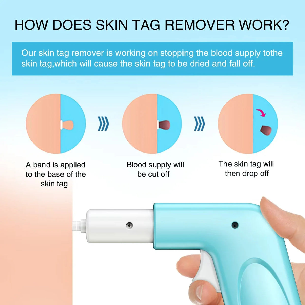 3 In 1 Auto Skin Tag Removal Kit Painless Mole Wart Remover Equipment Micro Skin Tag Treatment Tool Easy To Clean Skin Care Tool Quake