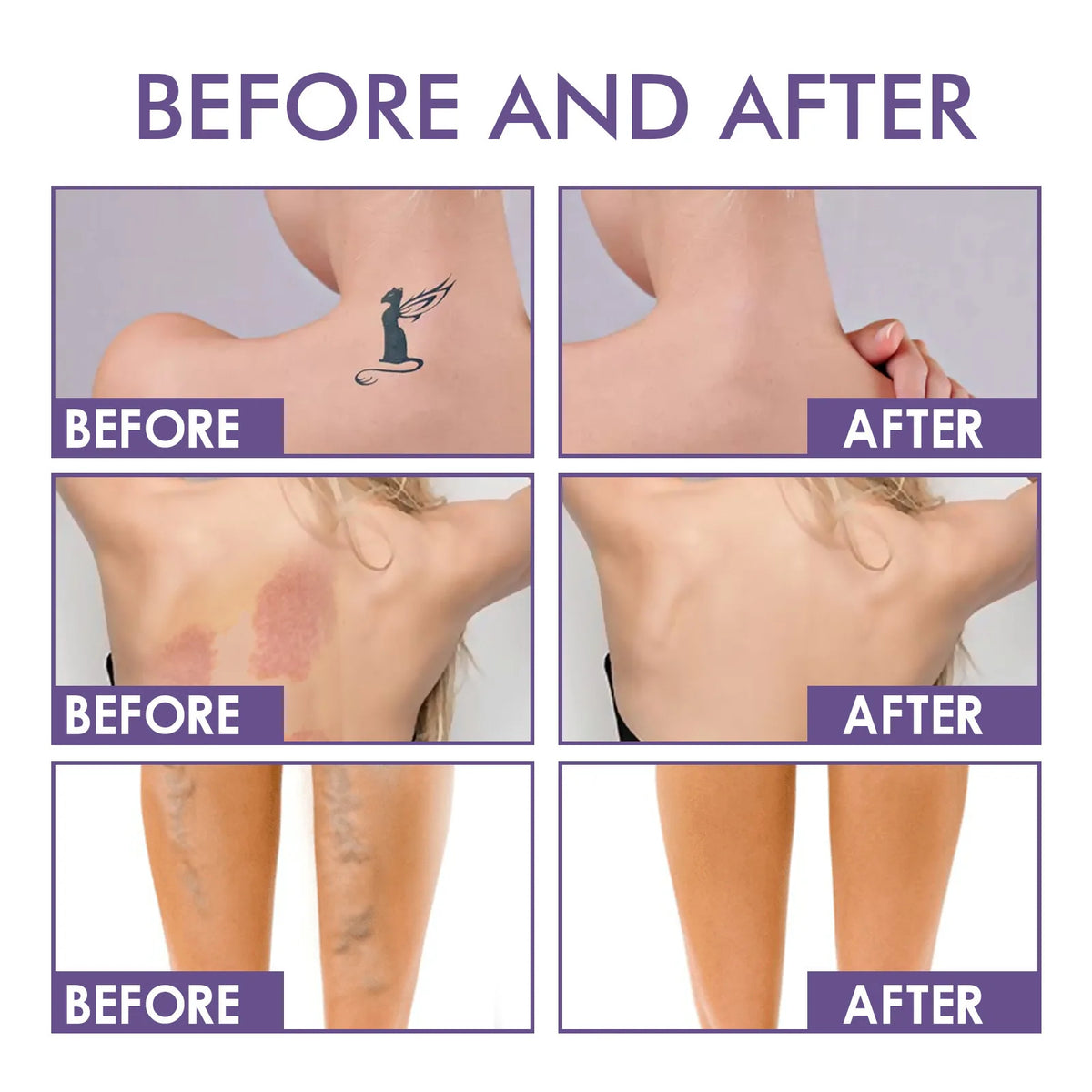 Waterproof Leg & Body Makeup-Concealer For Scars, Spots, Veins, Tattoos and More Blend Cosmetics Quake