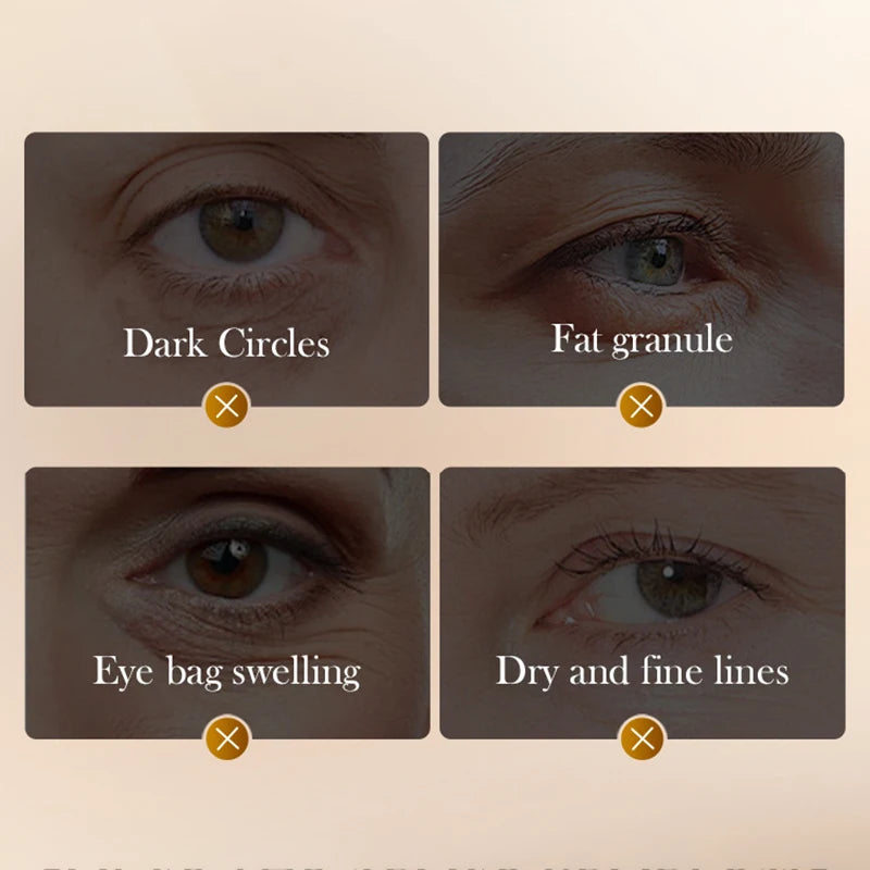SADOER Snake Venom Peptide Caffeine Anti Wrinkle Massage Eye Cream Anti Dark Circles Anti-Aging Moisturizing Eyes Skin Care Quake