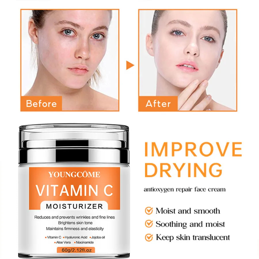 YOUNGCOME VitaminC Face Cream SkinCare Pigment Spots Freckles Remover Whitening Moisturizing Anit-Aging Beauty Health Cosmetics Quake
