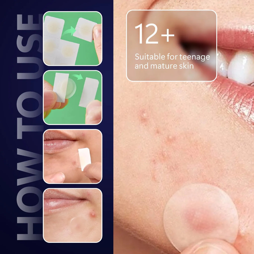 Micro Needle Pimple Patch (24 Pack) Hydrocolloid Micropoint Pimple Patch For Acne & Pimples Microdart Patch, Micro Dart Pimple P Quake