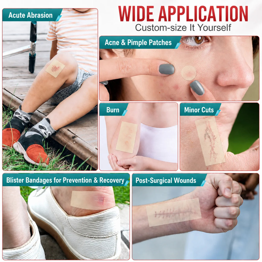 1 volume Pimple Patch Artificial Skin Wound Dressing Freely Cuttable Skin-Friendly Adhesive Keep Wound Clean 1 Roll Value Pack. Quake