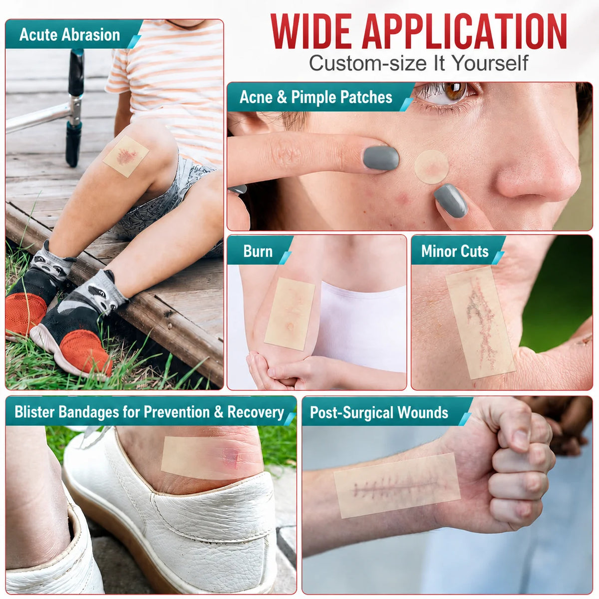 1 volume Pimple Patch Artificial Skin Wound Dressing Freely Cuttable Skin-Friendly Adhesive Keep Wound Clean 1 Roll Value Pack. Quake